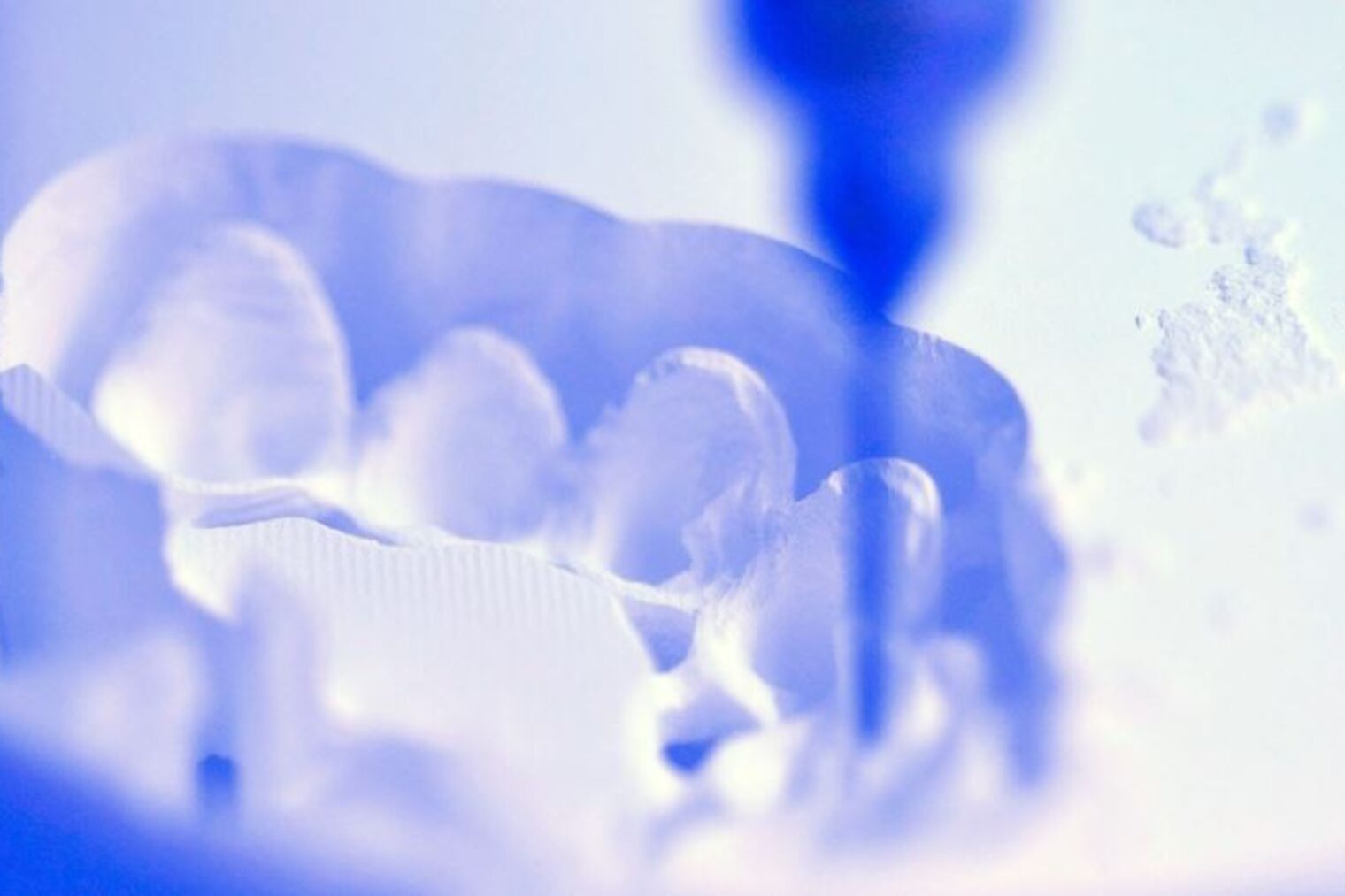 Ein Gebissabdruck mit Fräse